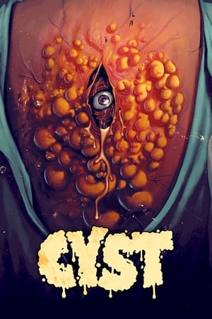 Nonton Film Cyst (2020) Terbaru Nonton Film Cyst (2020) Terbaru